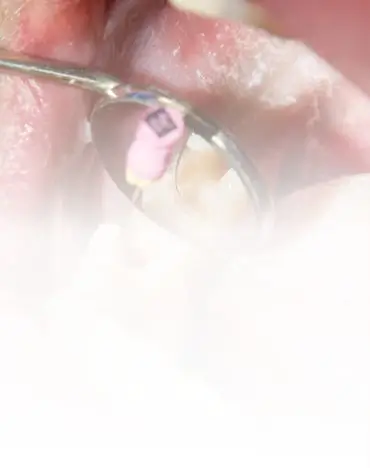 Card Background Image